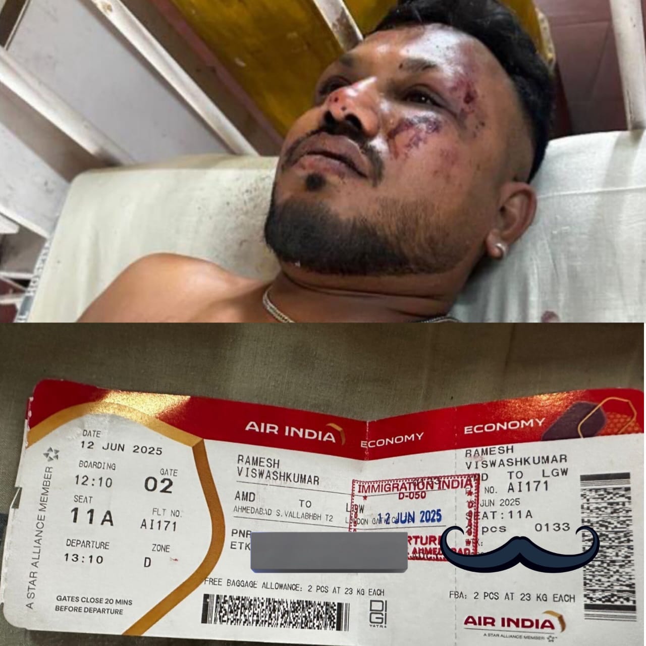 How Ramesh Viswashkumar, became the only survivor of air India crash